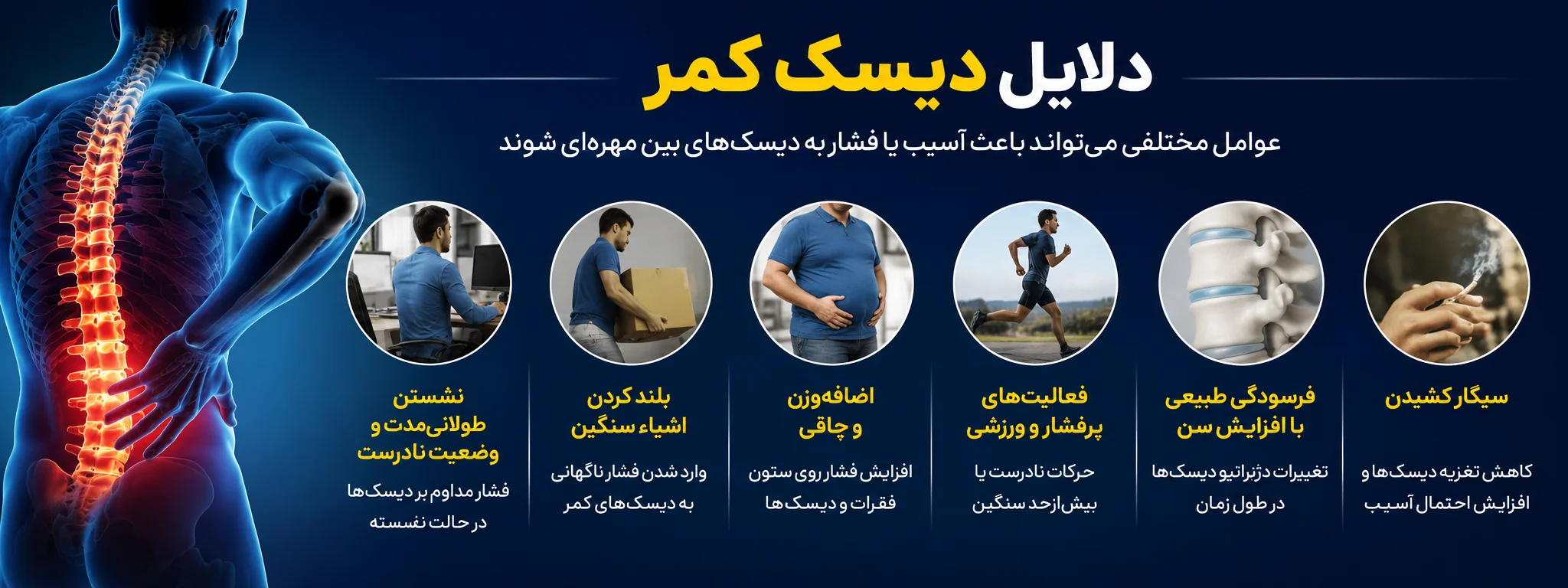 علل ایجاد دیسک کمر